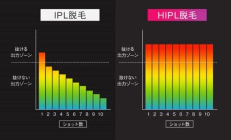 jovs脱毛器　iplとhipl　効果比較